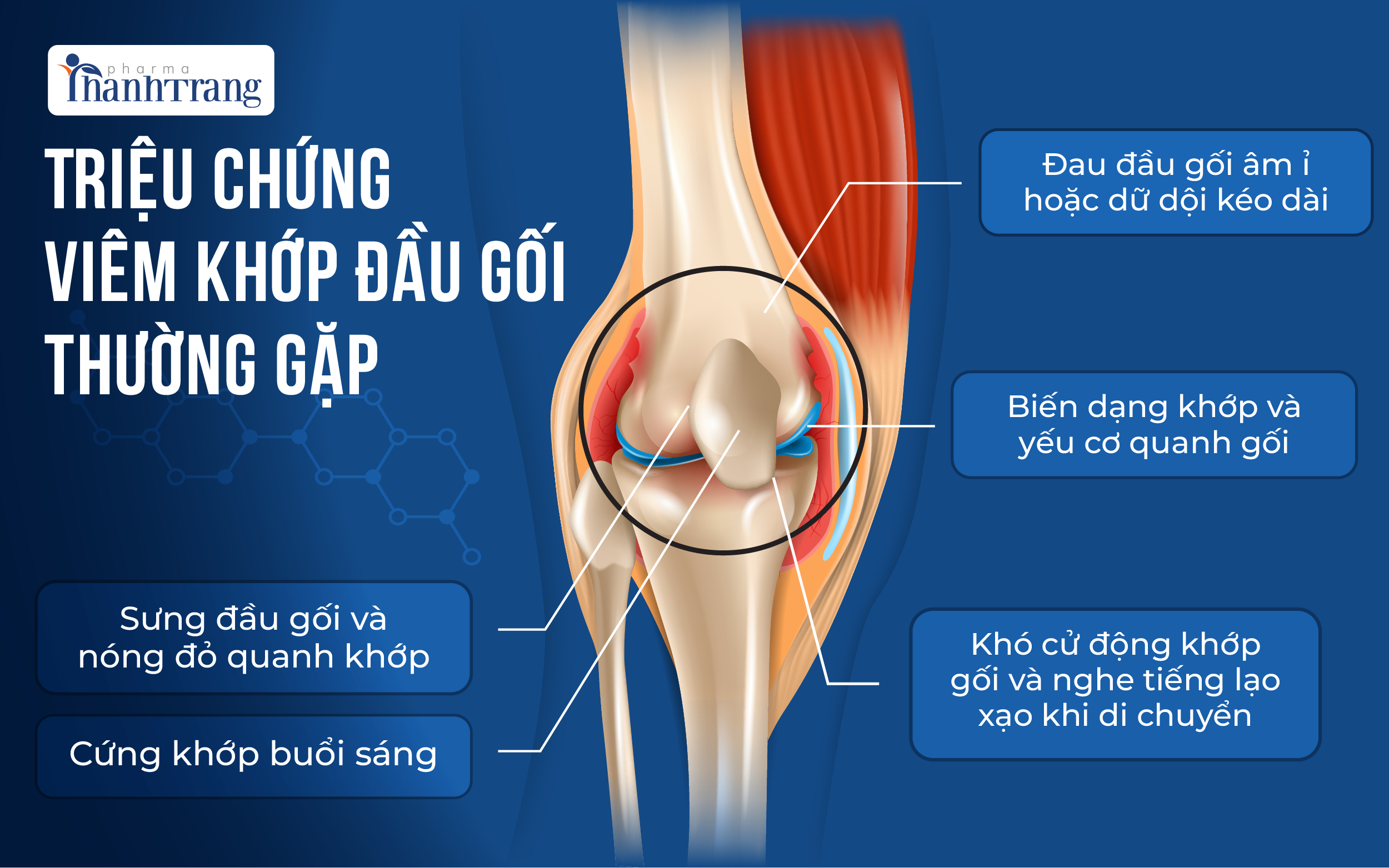 Trieu chung viem khop